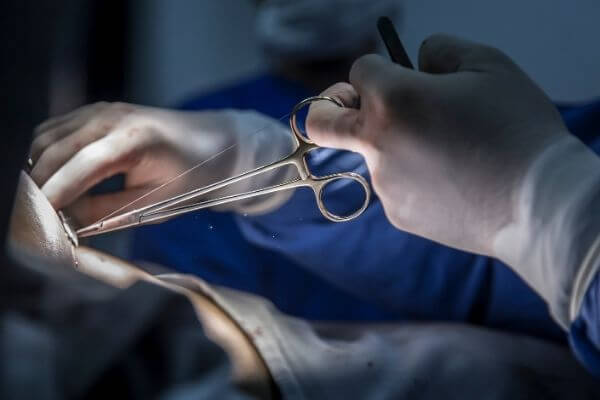 Origen de la sutura